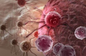 Fármaco experimental contra el cáncer rectal consigue la remisión de todos los pacientes en estudio