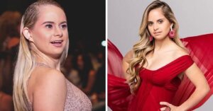 Promueven la belleza de la inclusión: primer modelo de Victoria´s Secret con síndrome de Down