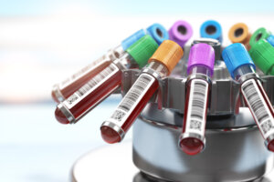 Nuevo análisis de sangre que detecta múltiples tumores antes de que se presenten síntomas