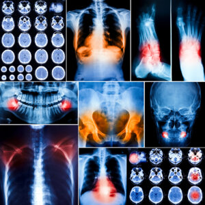 6 partes del cuerpo humano que hoy son casi «inútiles», según estudios