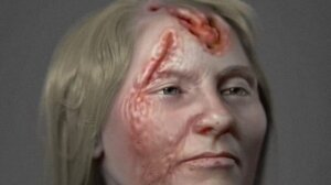 Rostro de mujer con sífilis: investigadores hacen reconstrucción de un caso del siglo XVI