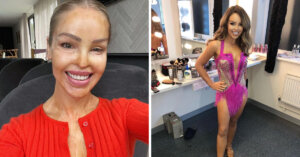 La increíble historia de Katie Piper, la modelo que sufrió un ataque con ácido y volvió a mirar al mundo con valentía